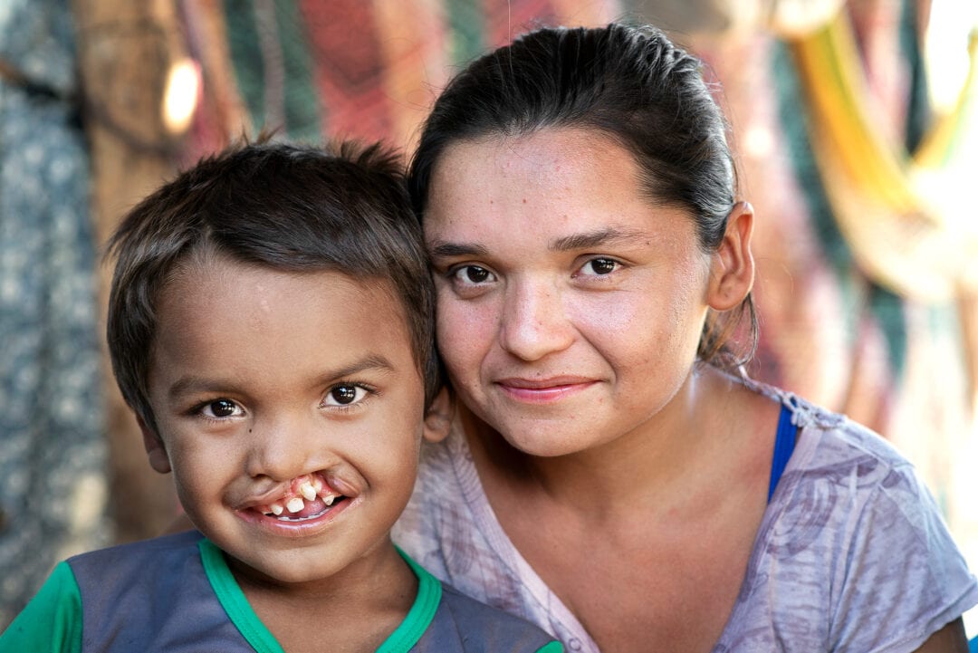 Seven-year-old Pedro and his mother, Marbelis. Photo: Rohanna Mertens.