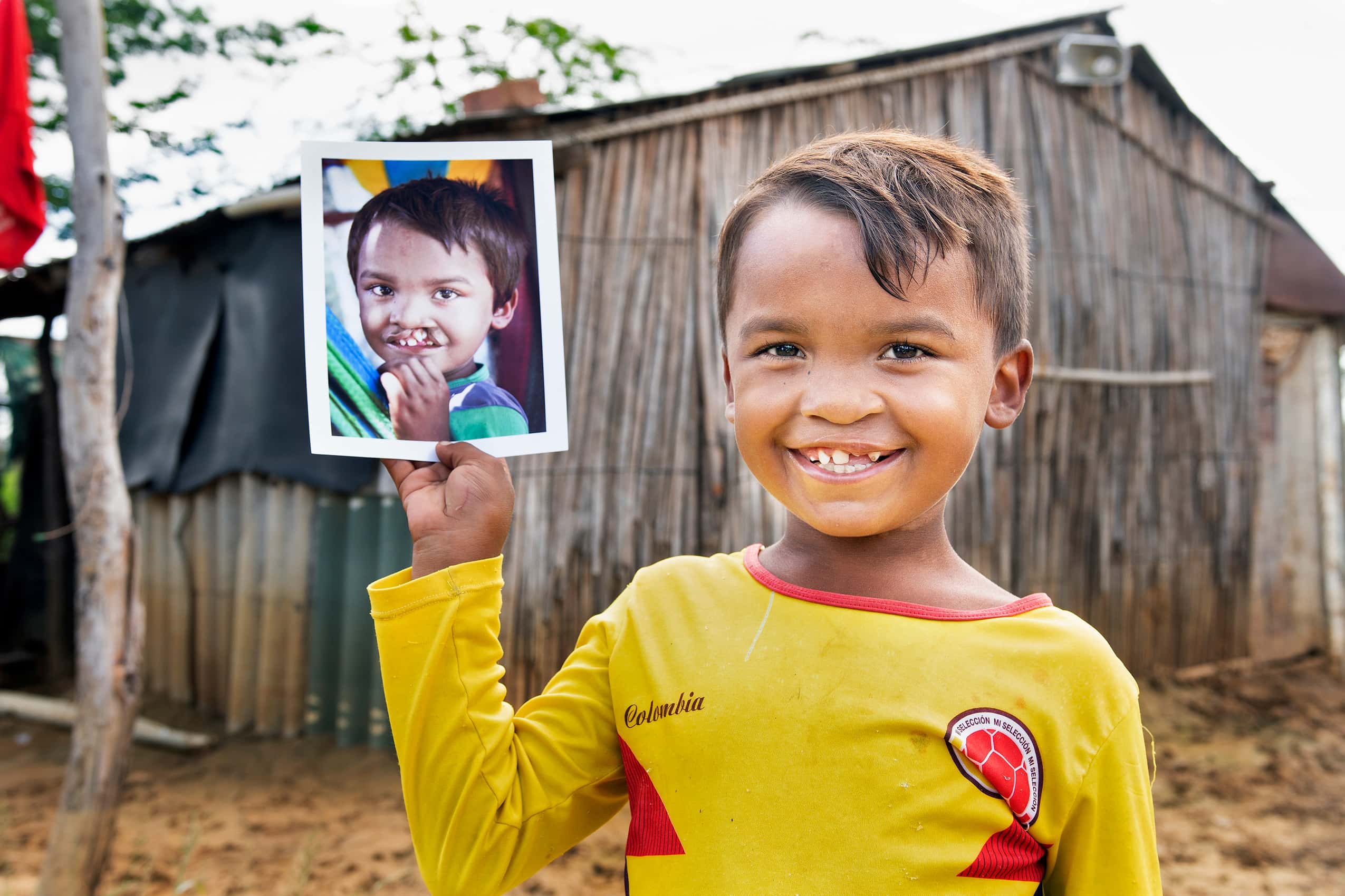 Pedro holding a photo of himself before cleft surgery. Photo: Camilo Zapata Fonnegra