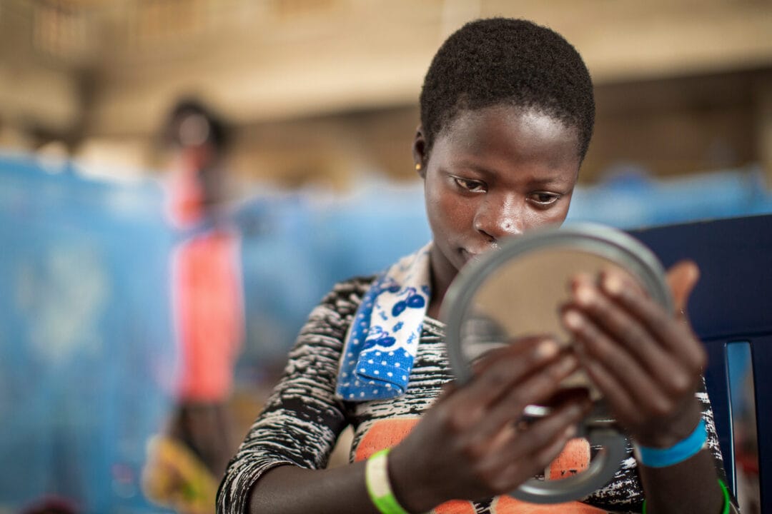 Faustina looks on the mirror for the first time after cleft surgery. Photo: Zute Lightfoot