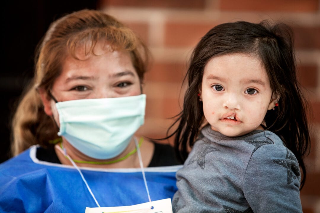 Alison with her mum, before cleft surgery. Photo: Carlos Rueda