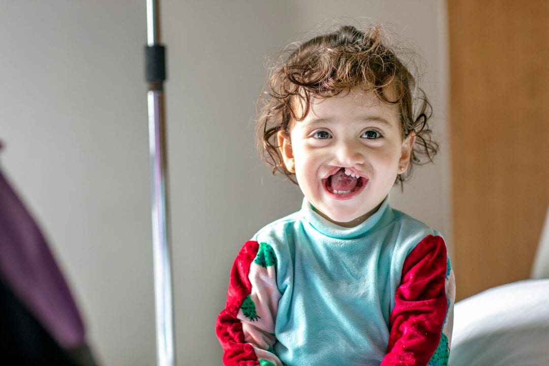 Janat, now almost 2 years old, shares her biggest smile during screening at Operation Smile Morocco’s October 2021 surgical programme in Casablanca. Photo: Jasmin Shah.