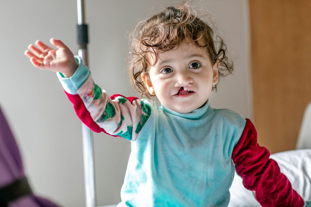 Toddler Janat waves before cleft surgery