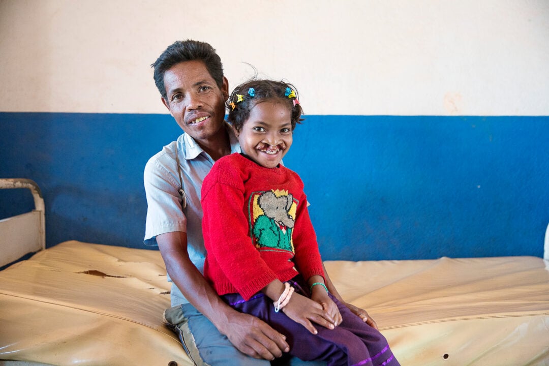 girl in red jumper with cleft lip and palate sitting on her Dad's lap