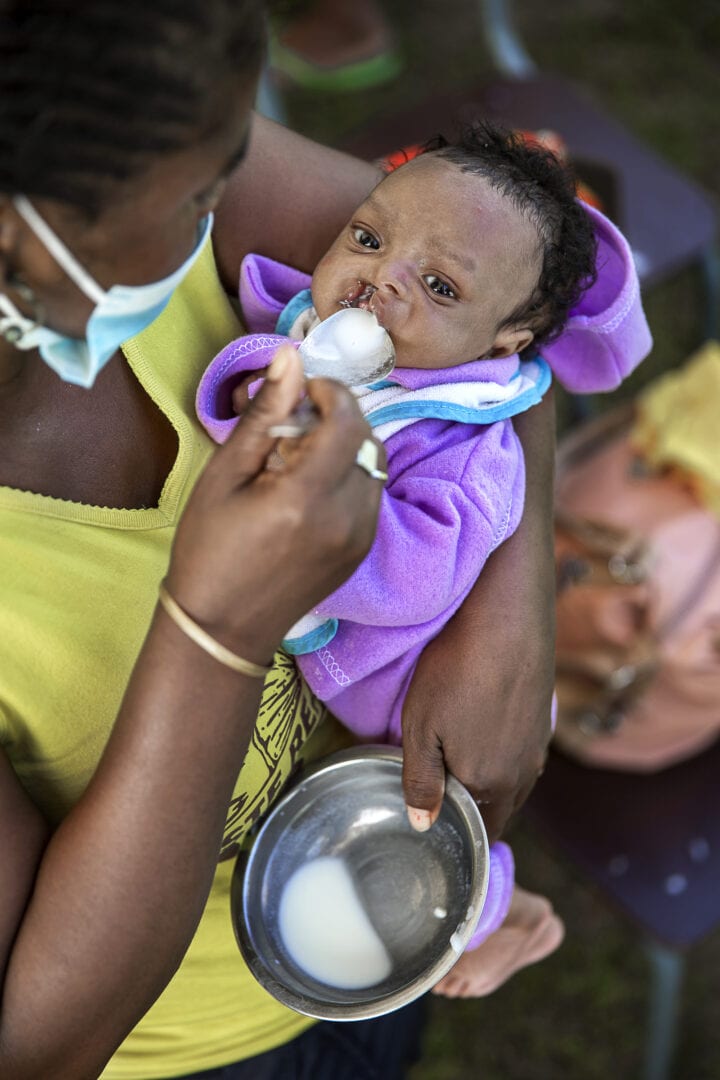 Leásy, a seven-week-old baby boy born with a cleft lip and palate, rests in the arms of his grandmother,