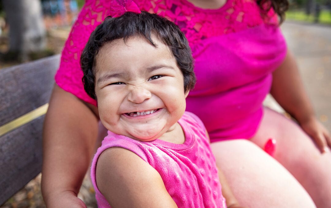 Toddler female full of smiles after her cleft surgery