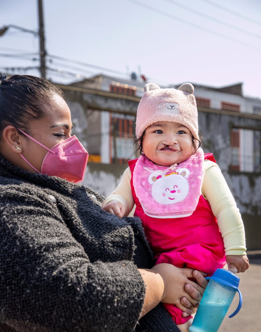 Mum holds daughter, with cleft lip and cleft palate