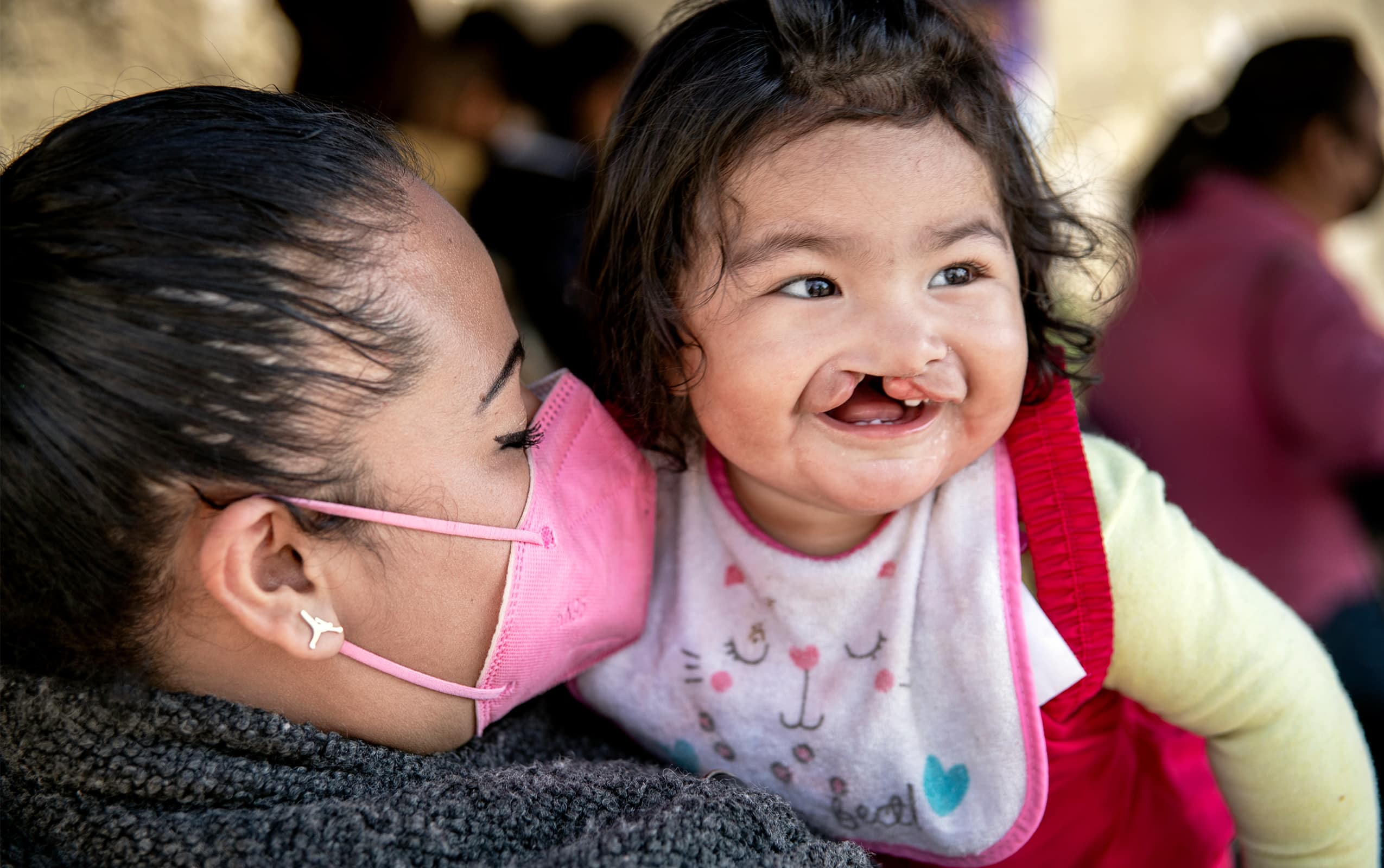 Mum holding baby girl before her cleft lip and cleft palate surgery