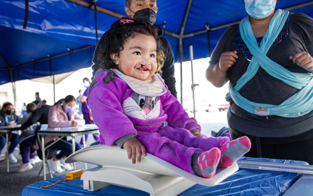 Baby girl in been weighed in screening cleft lip and cleft palate surgery screening clinic in Mexico