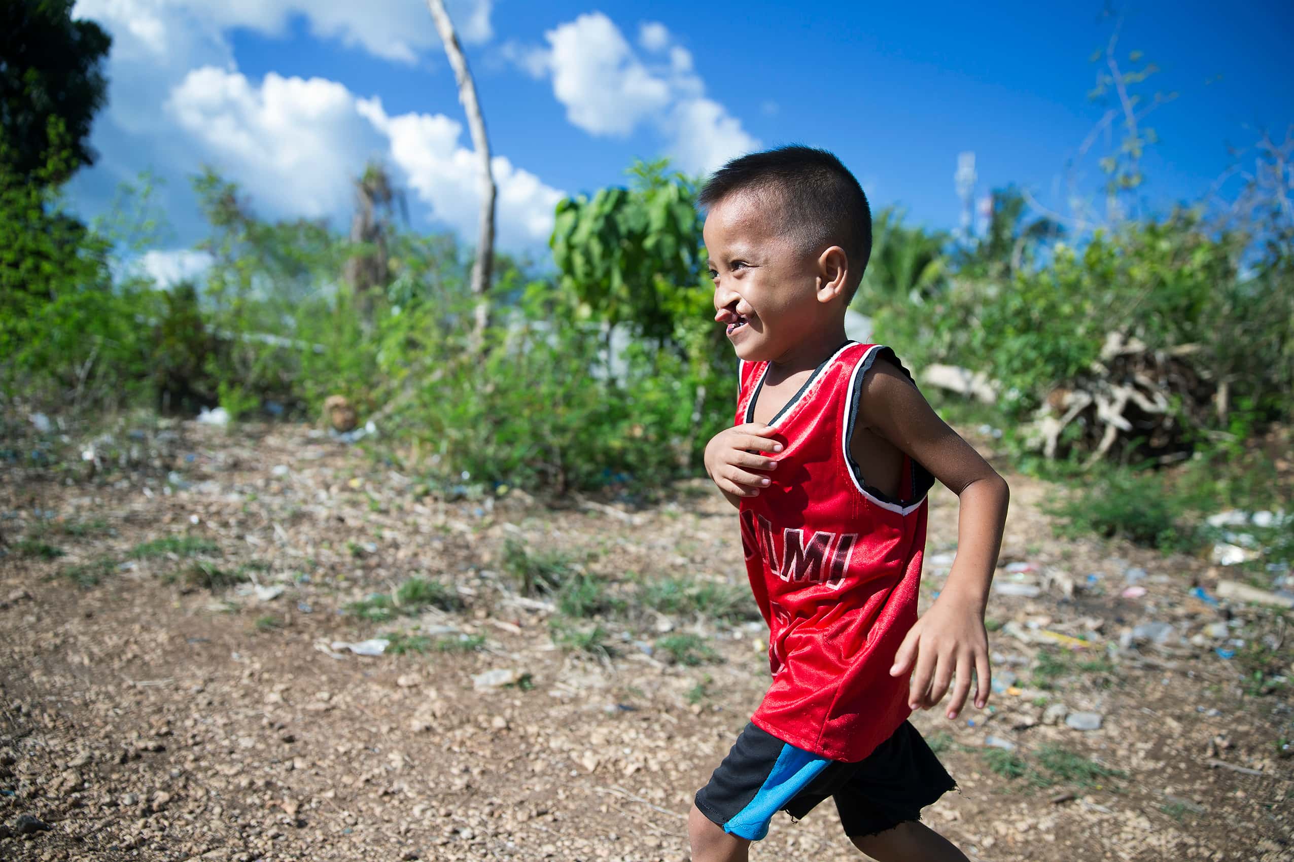 Joseph runs in an open filed, before cleft surgery. Photo Jörgen Hildebrandt