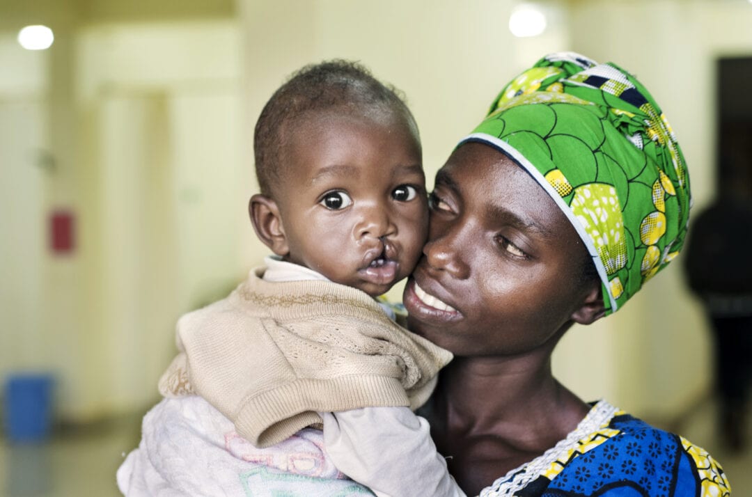 Robert had cleft surgery during the Surgical Training Programme. Photo: Margherita Mirabella