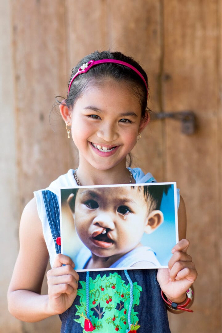 11-years-old Ngan, holds a photo of herself before cleft surgery. Photo: Peter Stuckings