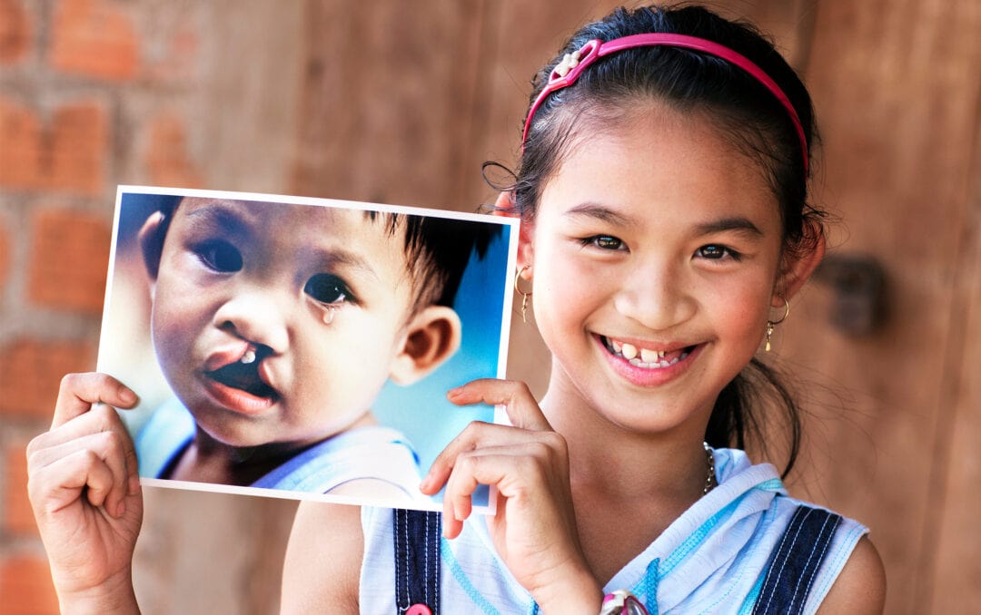 Girl with a repaired cleft lip and cleft palate holding up a photo of herself before surgery