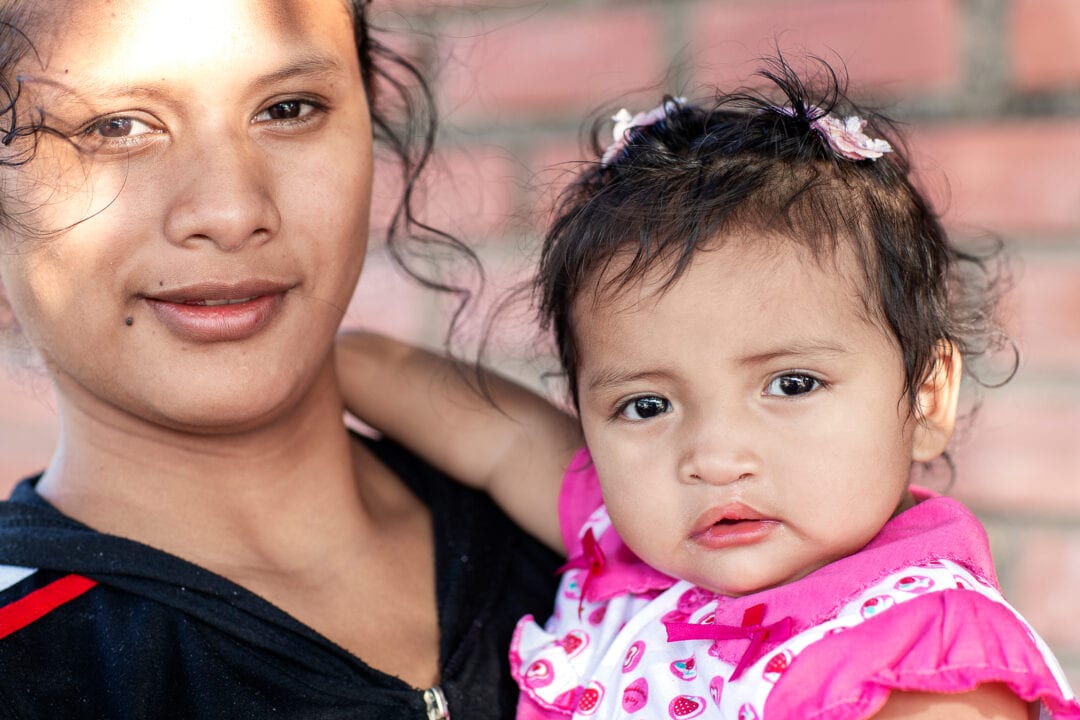 Baby girl with her mum after cleft surgery