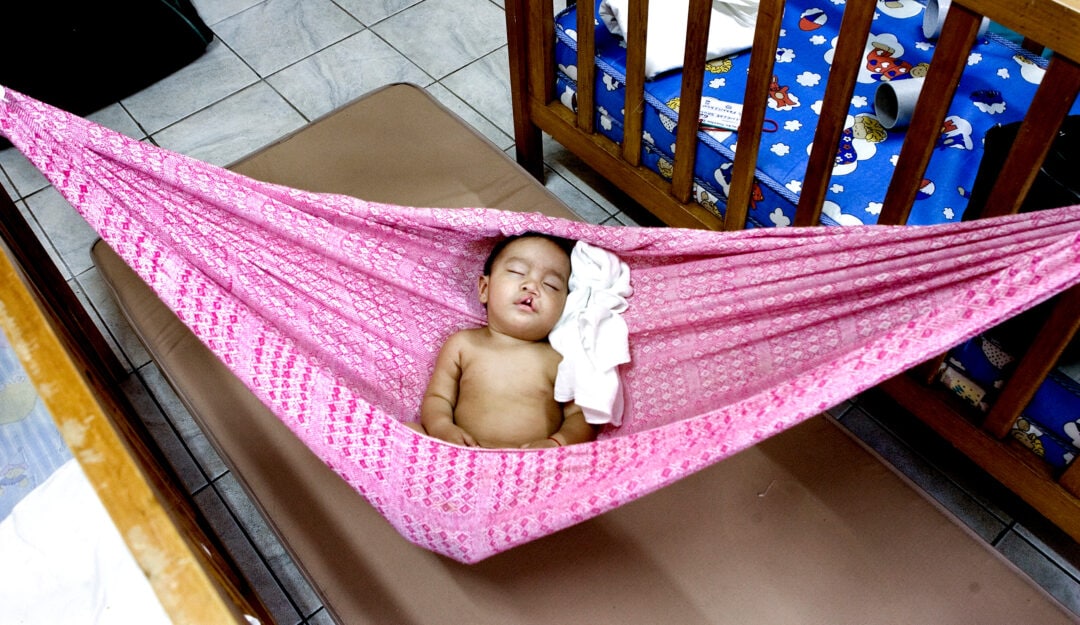 Toddler sleeps in hammock before waiting for cleft surgery in Brazil. Photo: Marc Ascher