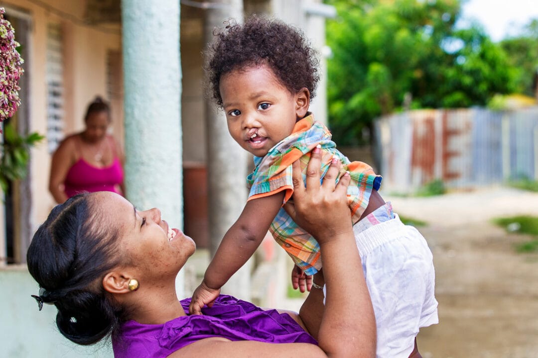 20-months-old Kendri with her mum, before cleft surgery. Photo: Marc Ascher