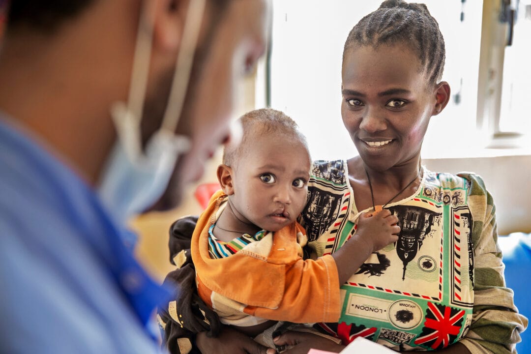 15-month-old Yalfal with his mum, before cleft surgery. Photo: Jorgen Hildebrandt