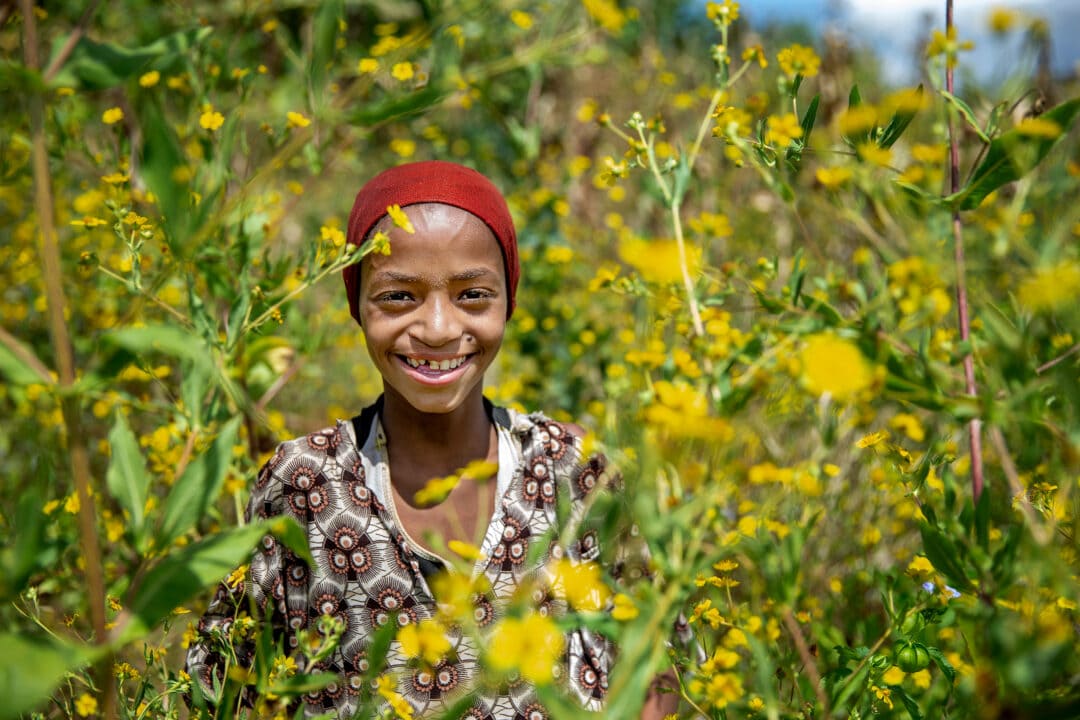 Nazifa, after cleft surgery. Photo: Jorgen Hildebrandt