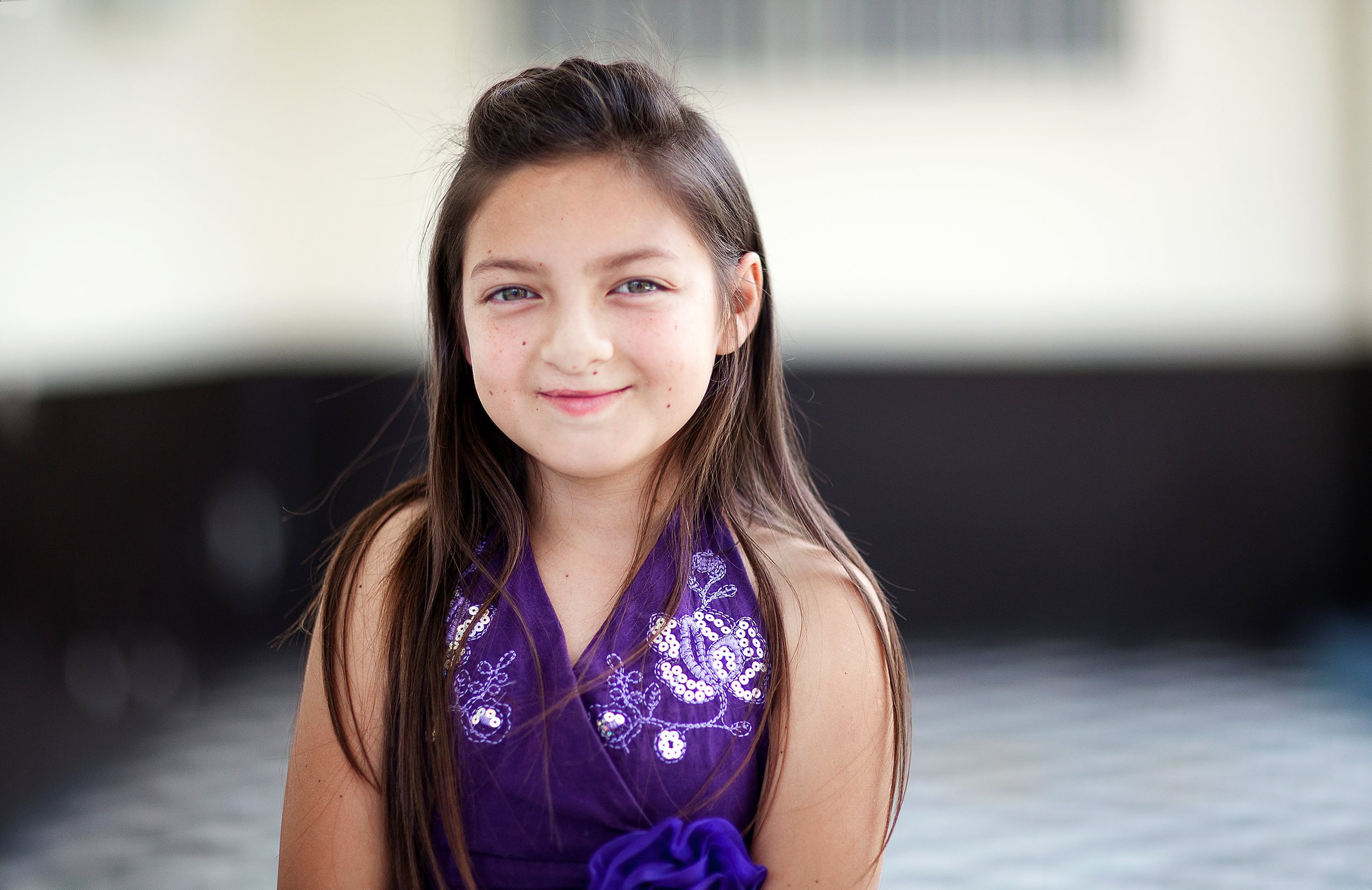 10-year-old Britany after cleft surgery. Photo: Carlos Rueda