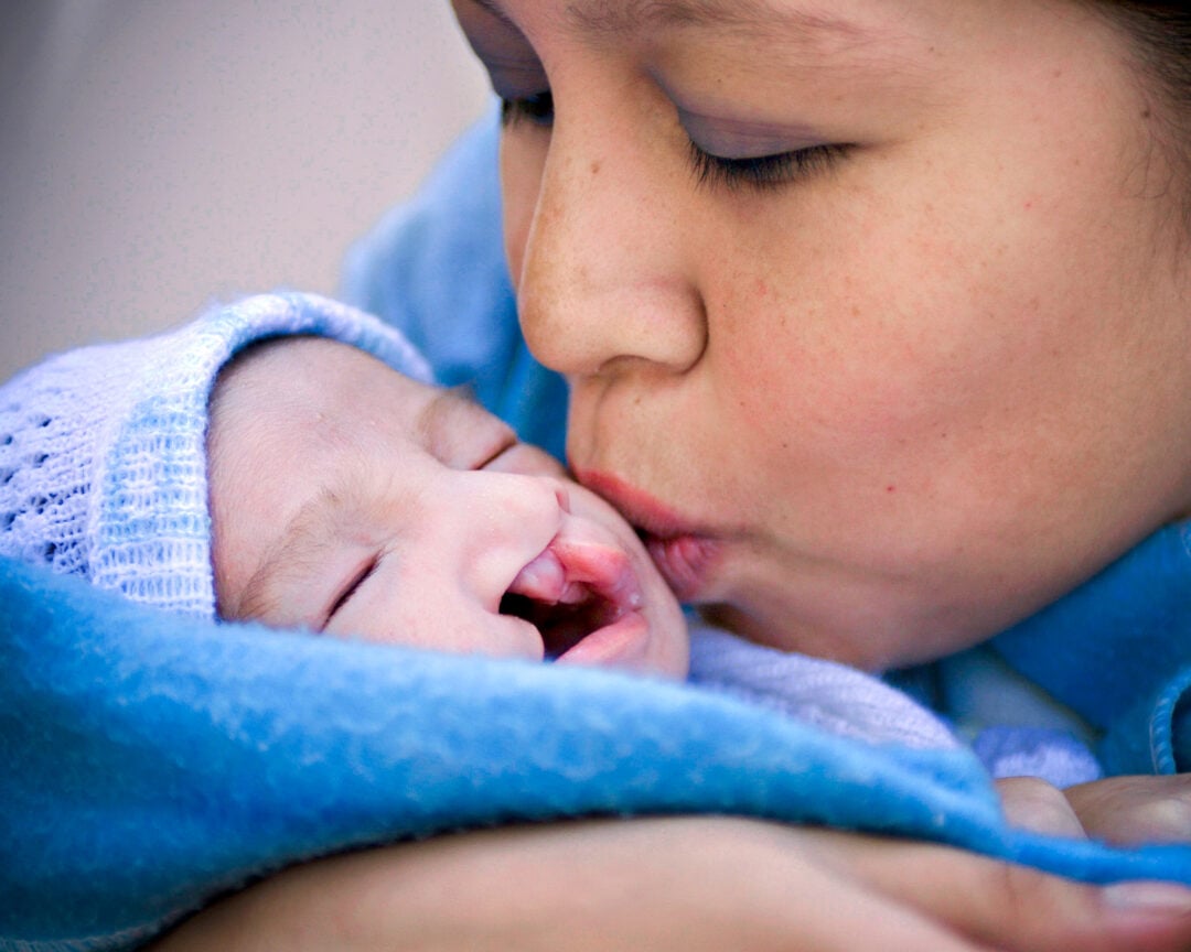 Mum kisses newborn with cleft lip and cleft palate. Photo Operation Smile