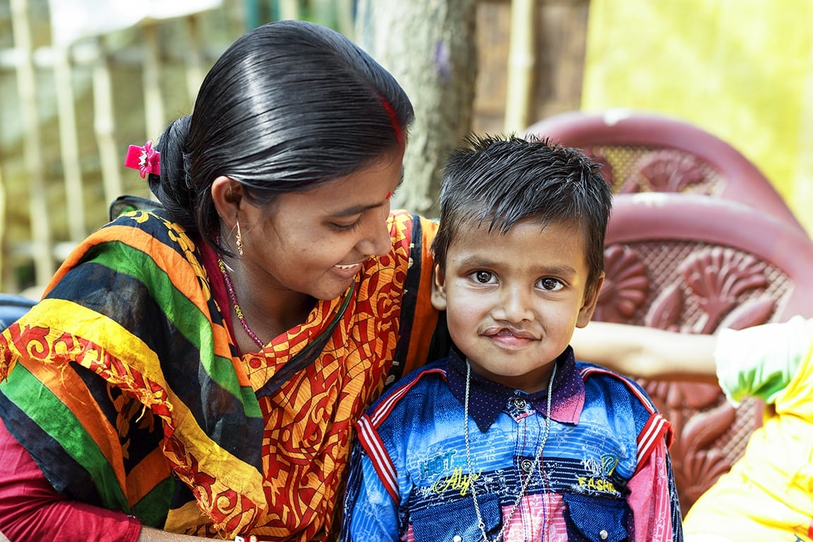 Shyham and his mum, before cleft surgery in India