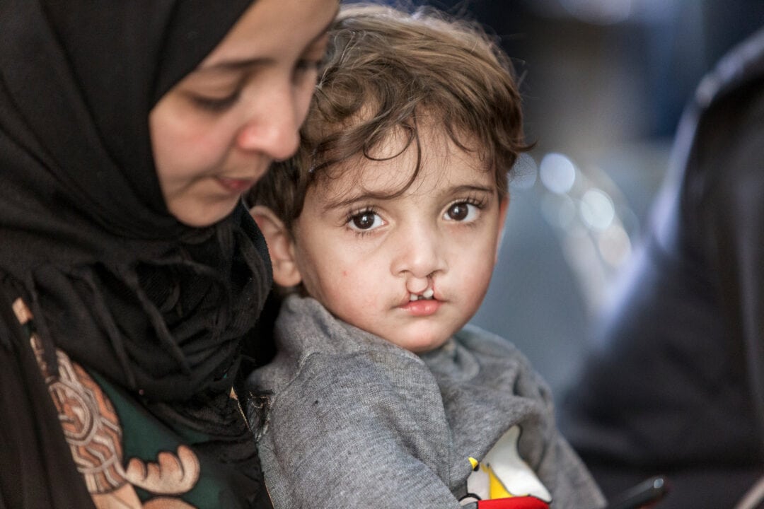 Boy before cleft surgery. Photo: Carlos Rueda