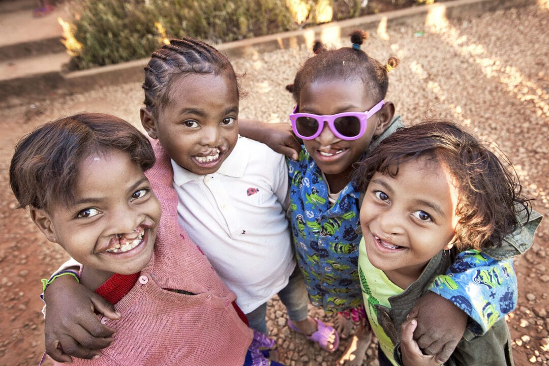 Clara and other patients playing before their cleft surgery