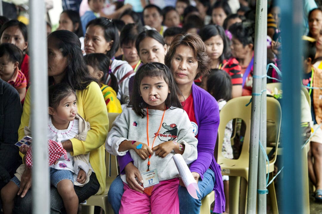 Patients with cleft waiting for surgery