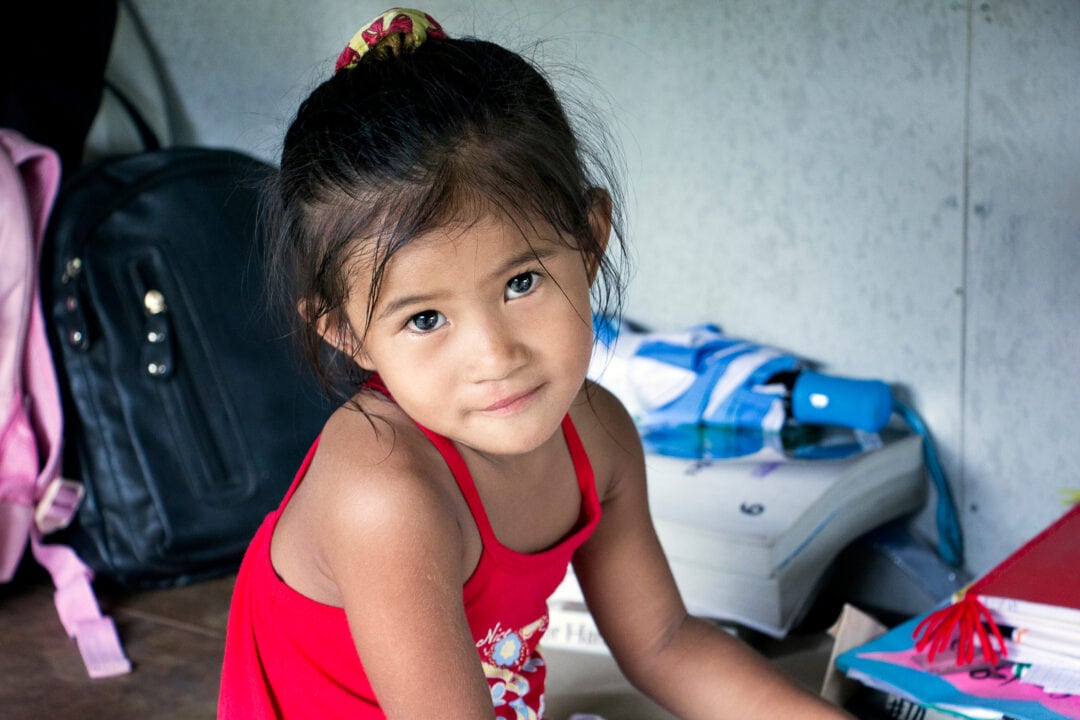 Girl with a repaired cleft lip