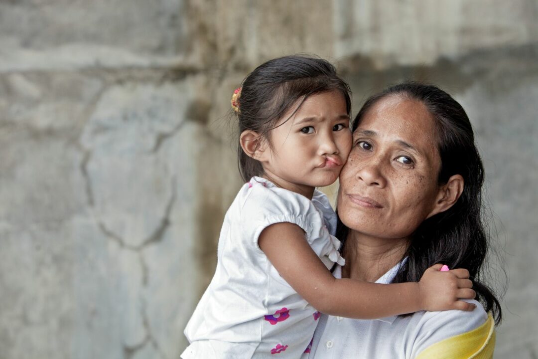 Arlyn and her mum before surgery to correct Cleft lip and palate