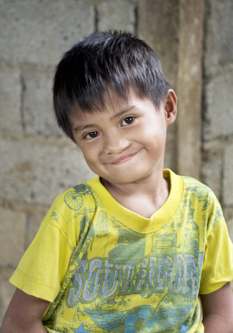 Aljay after his life-changing cleft surgery