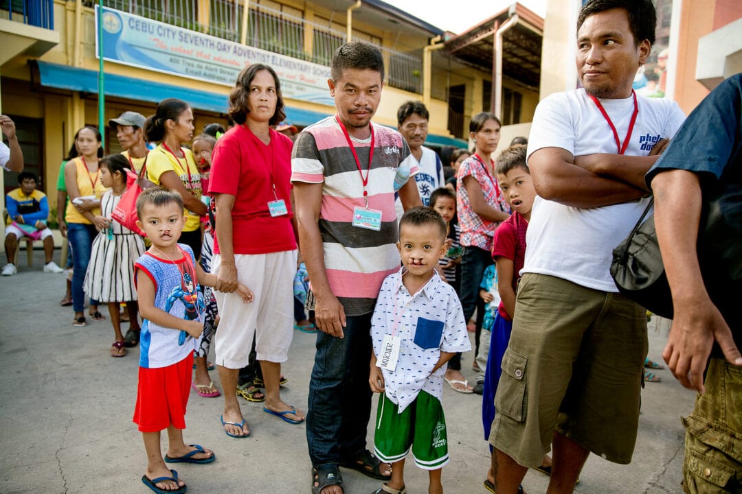 Joseph and Julito at the programme with other children with cleft lip and cleft palate