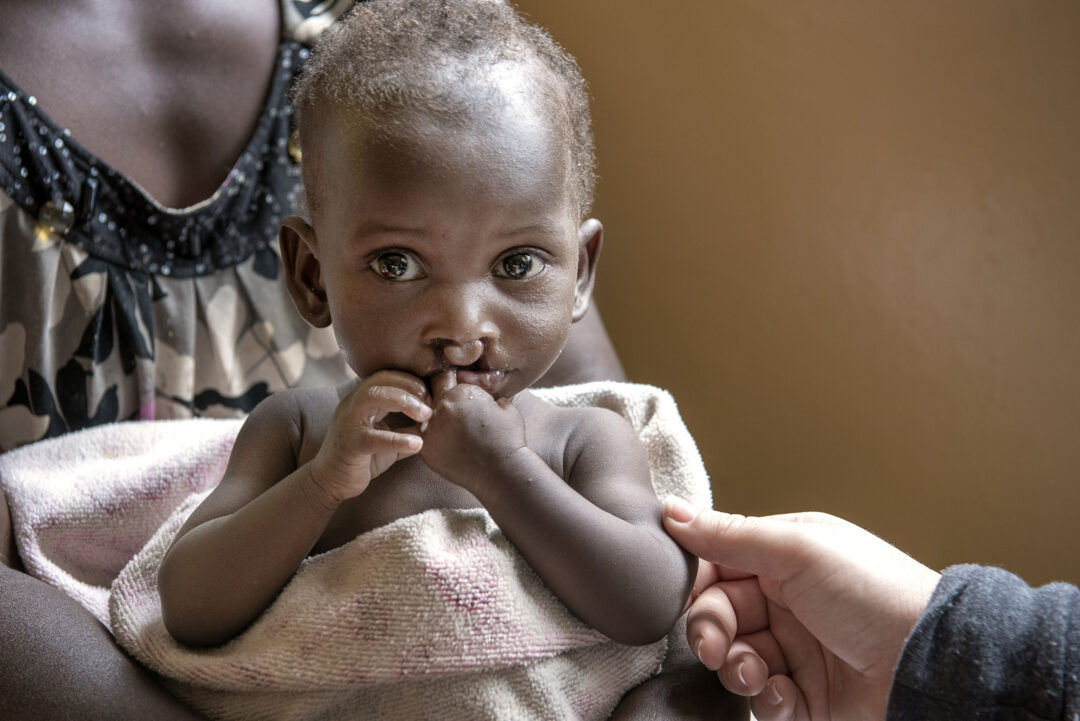 Divine from Rwanda during the nutrition check up