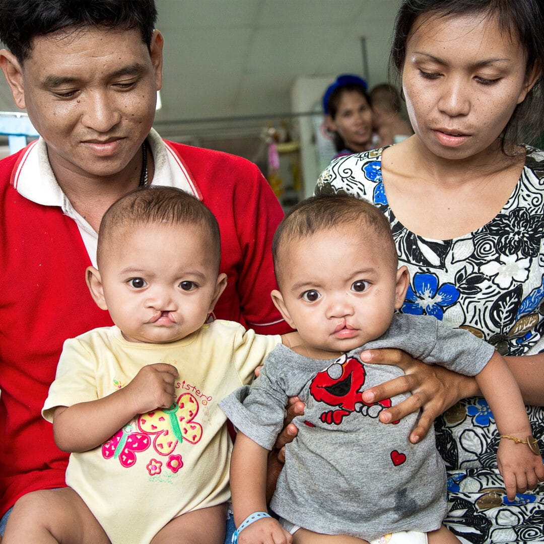 Twin brothers with cleft with mum and dad