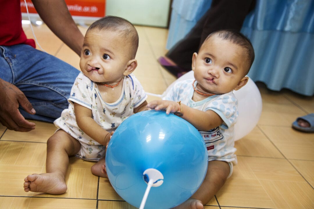 Ou and Lak before their life changing cleft surgery