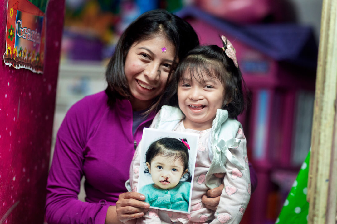 Mum and daughter with photo of girl before cleft surgery