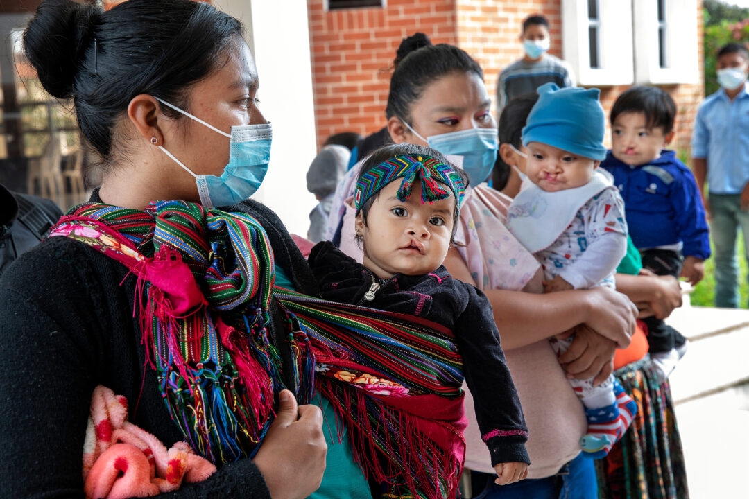 Nine-month-old Daleyza before cleft surgery. Photo - Jasmin Shah