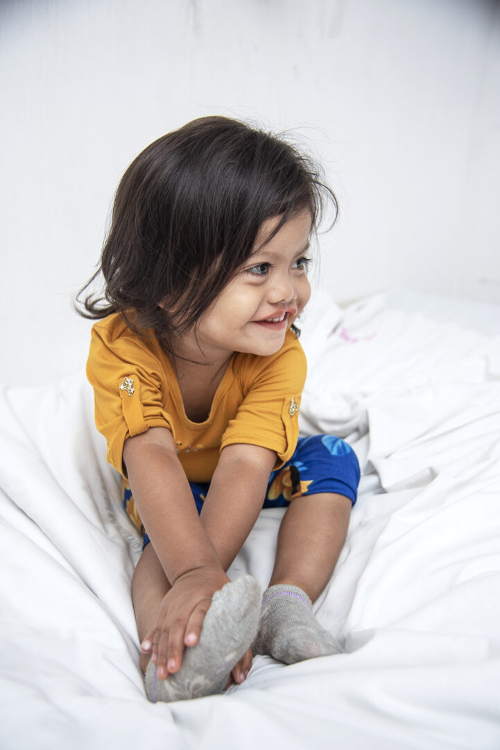 Toddler with cleft lip