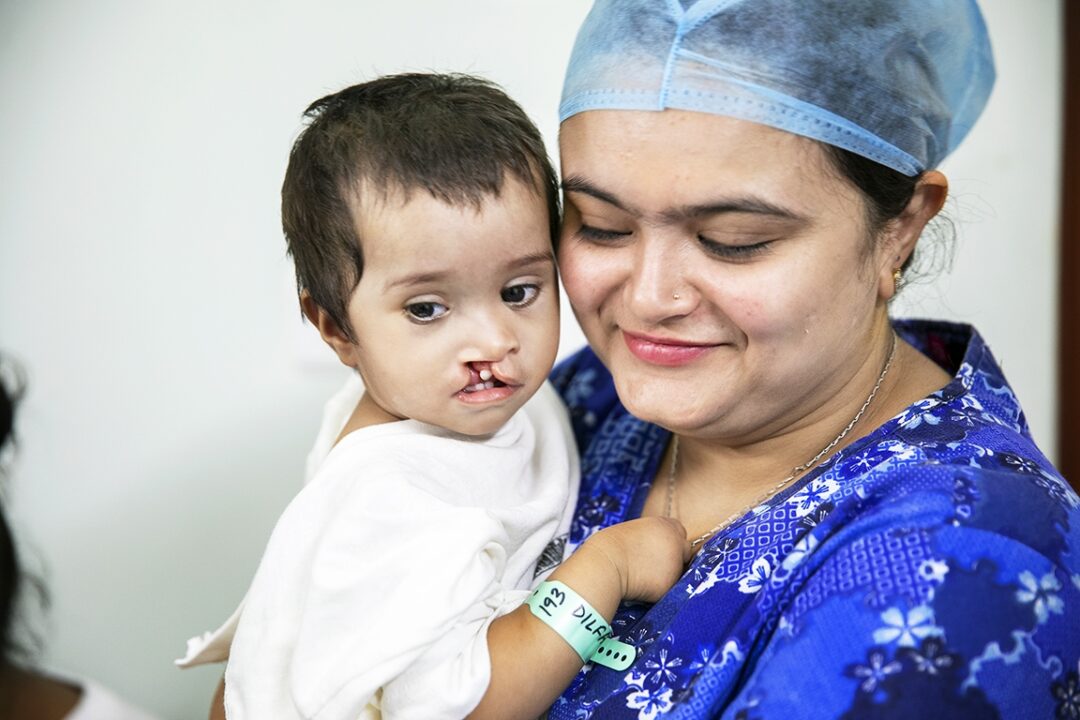 In 2018, Dilfa and her family connected with the local Operation Smile volunteer team in India who provided her with a surgery that would forever change her life. Photo: Jasmin Shah.