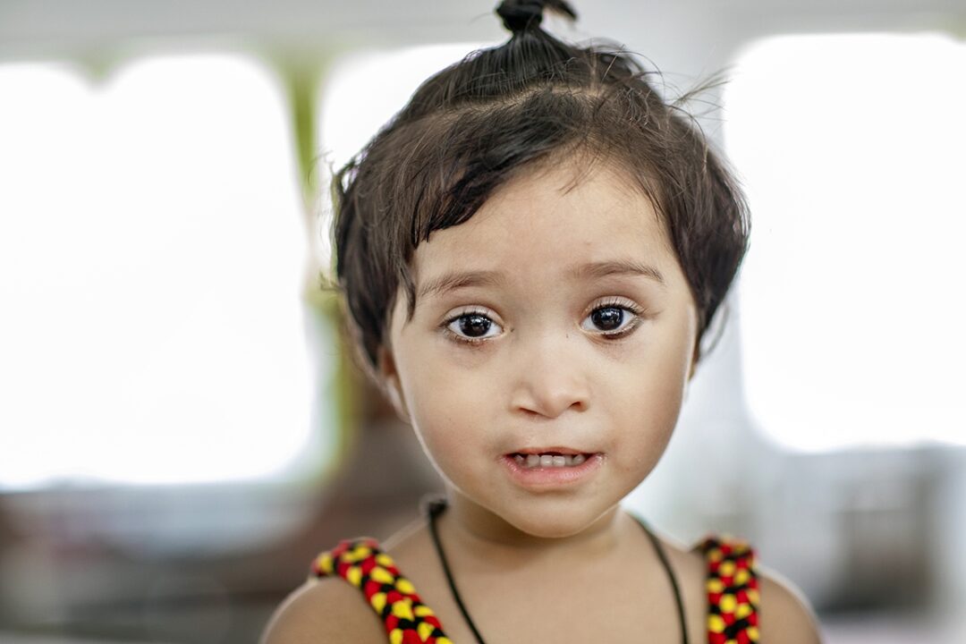 One year after her life-changing cleft lip surgery, 18-month-old Dilfa shares her beautiful smile after receiving care from Operation Smile India. Photo: Jasmin Shah.