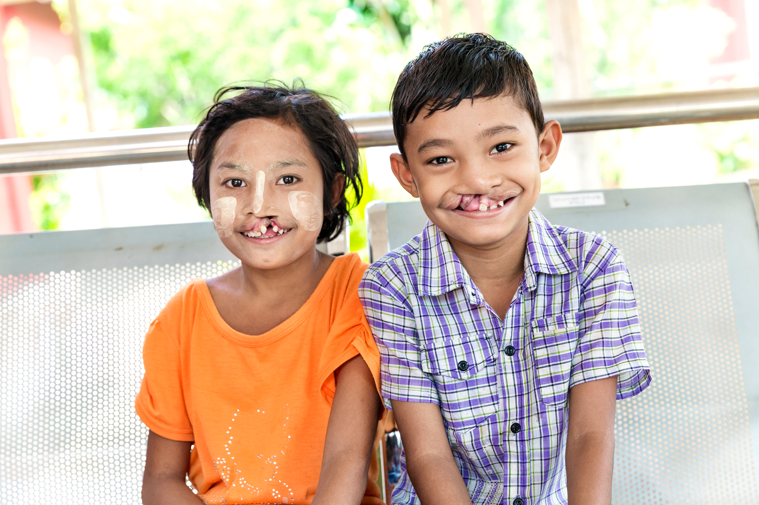 Boy and girl with cleft lip and cleft palate.