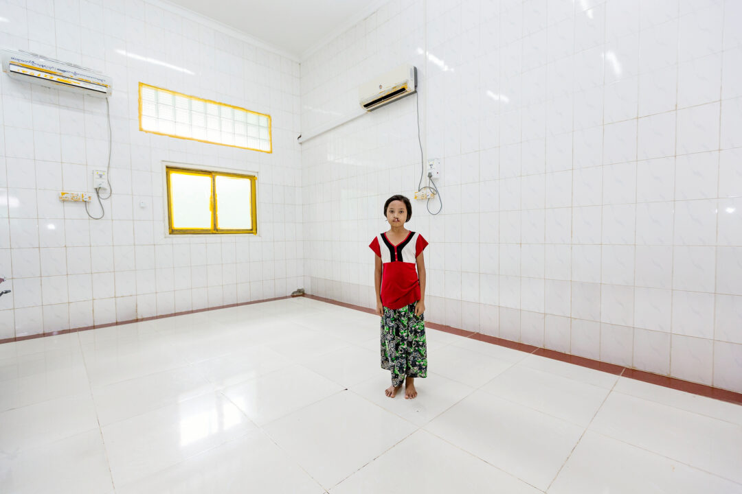 girl with cleft stands in an empty room