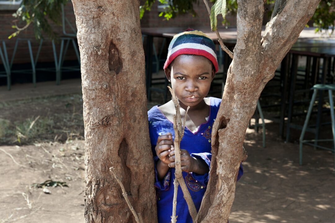 10-year-old Mina, before cleft surgery. Photo: Margherita Mirabella.