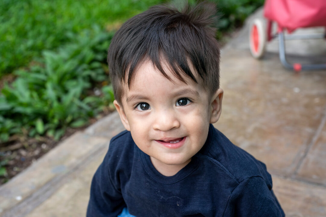 Arian a year after his cleft surgery. Photo: Margherita Mirabella