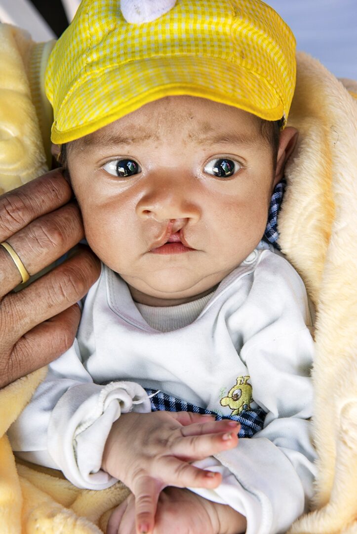 Two-month-old Kyungmin during screening day of Operation Smile Peru's 2019 medical programme. Photo: Margherita Mirabella.