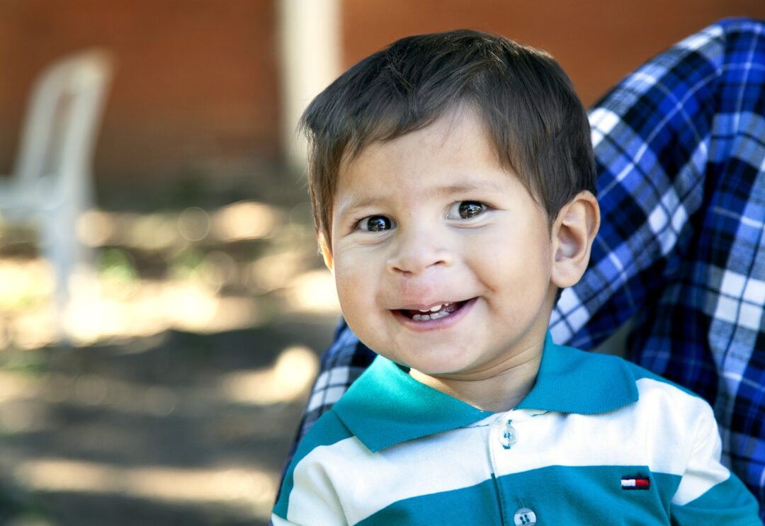 Alex after cleft surgery. Photo: Carlos Rueda.