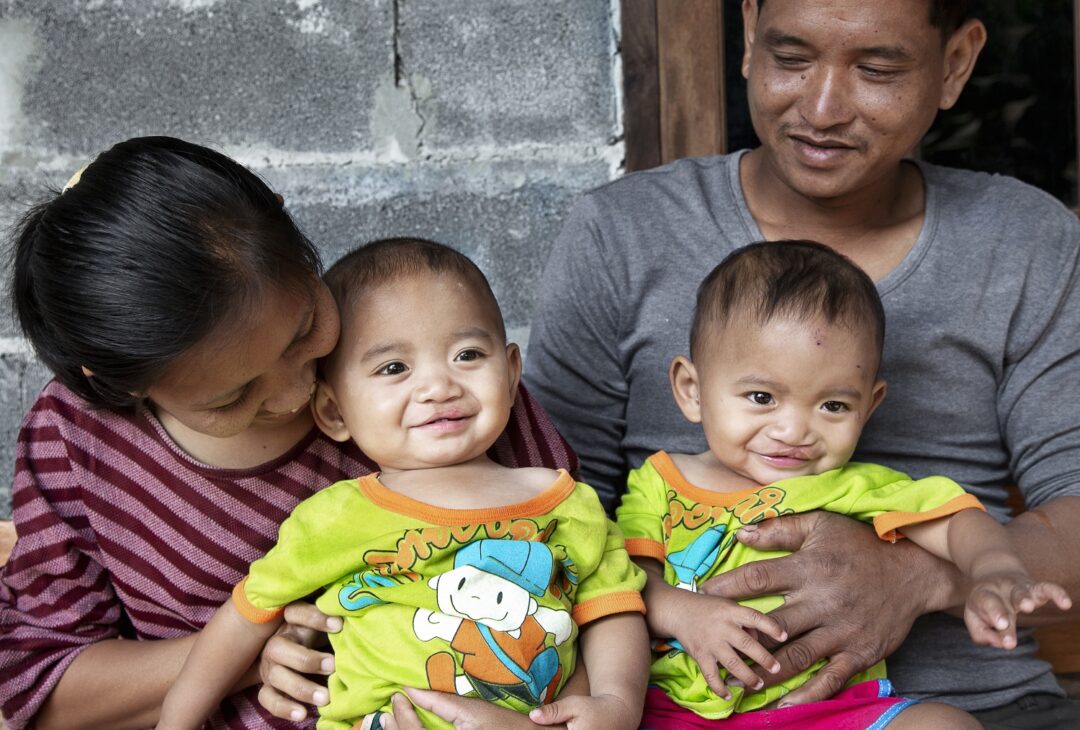 Ou, left, and Lak, one year after their cleft lip surgeries. Photo: Peter Stuckings.