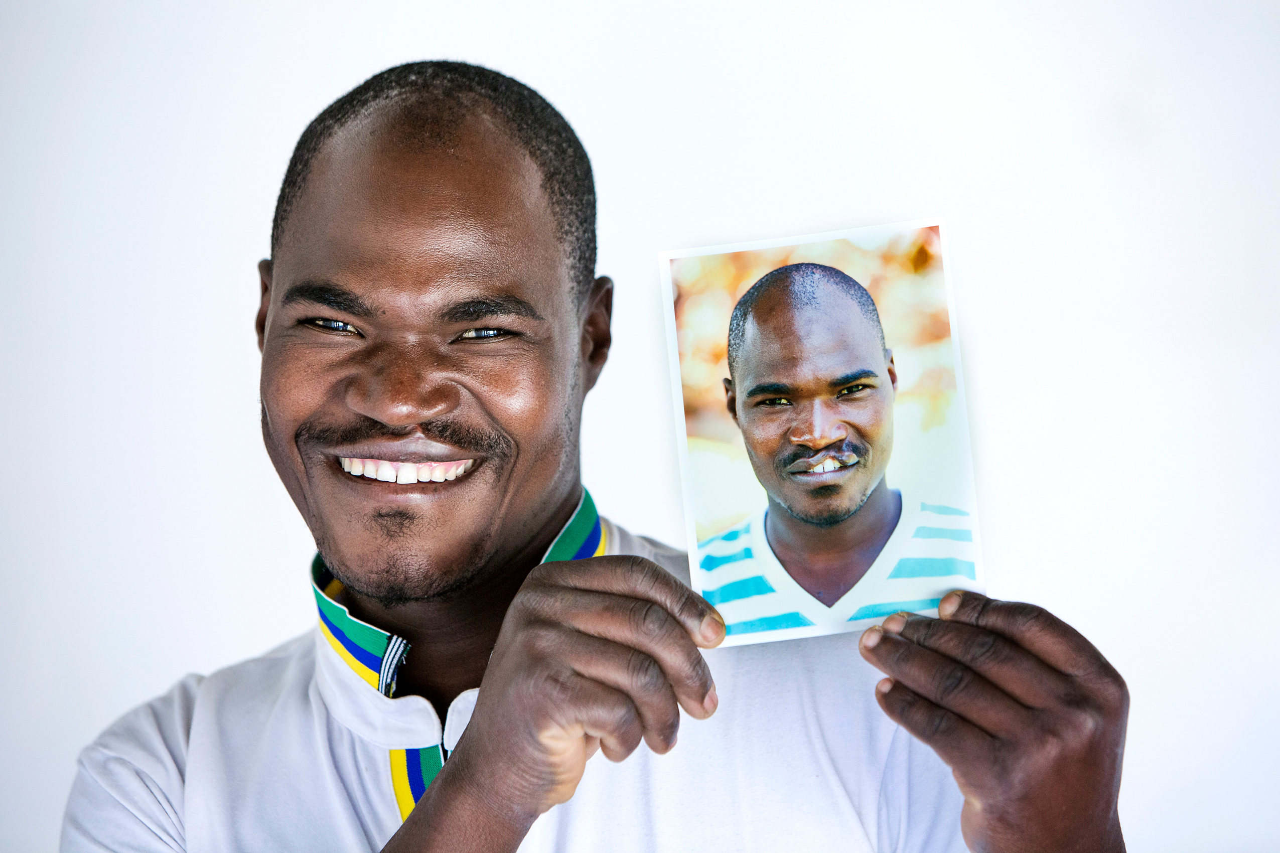 Cleft in adult. Ephraim holds a photo of himself before cleft surgery.